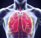 Fibrose pulmonaire idiopathique : symptômes, diagnostic et traitement